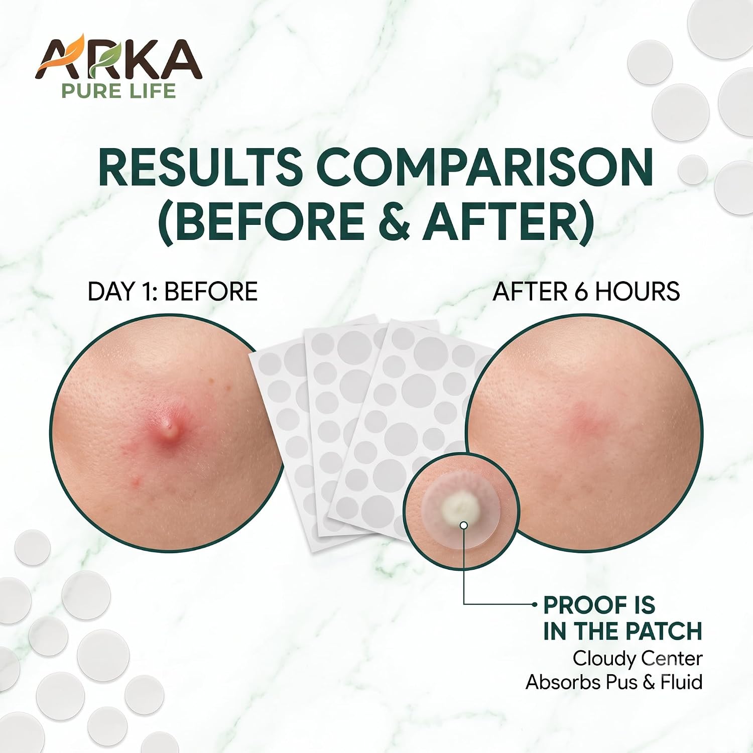Acne Pimple Patch, 36 Dots 8 Acne Pimple Patch, 36 Dots - Image 8